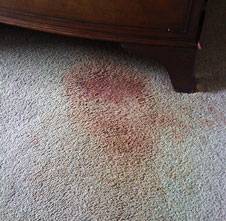 Removing Blood Stains